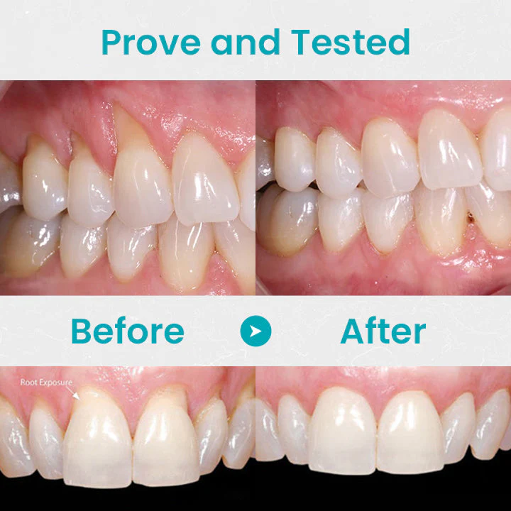 🔥Last Day 69% OFF-SEURICO™ Gum Shield Therapy Gel - Image 11