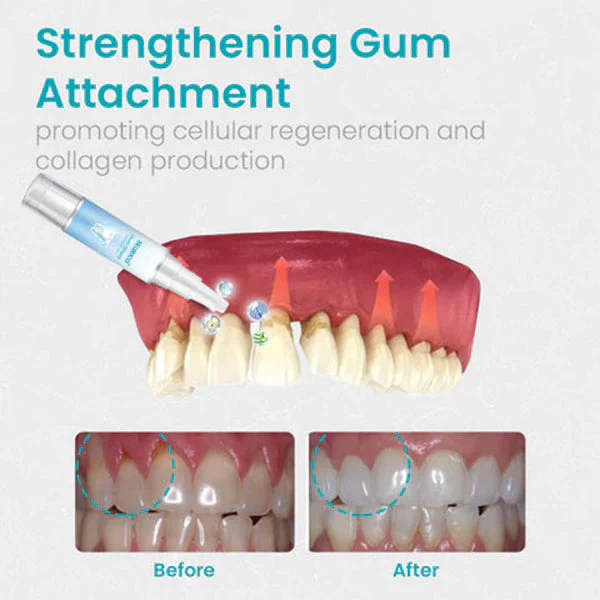 🔥Last Day 69% OFF-SEURICO™ Gum Shield Therapy Gel - Image 8